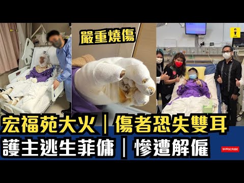 宏福苑大火|傷者恐失雙耳|護主逃生菲傭|慘遭解僱 #東張西望 #tvb