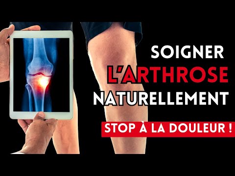 3 conseils pour soigner l'arthrose sans médicament (et comment agir dès aujourd’hui)