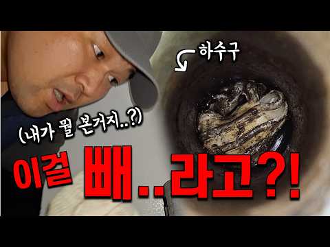 "Can I get this out?" The shocking cause of a sink clog in Suyeong-gu, Busan, confirmed by endosc...