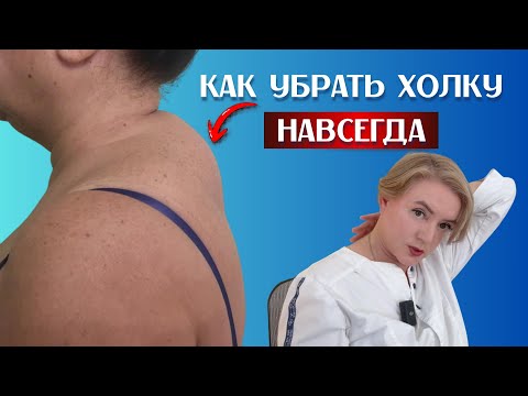 Как убрать вдовий горб на шее при помощи горячей воды и деревянной ложки