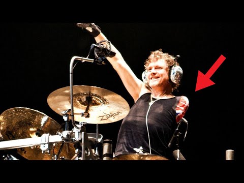 The drummer who lost an arm