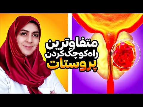 ۷ روش کاملا متفاوت و راحت برای کوچک کردن پروستات_روشهای بی خطر و موثر در کوچک کردن پروستات