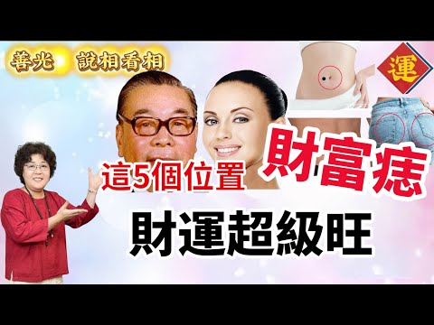 最好的財富痣 有5個位置,事業財運超級旺。