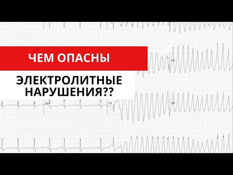 Электролитные нарушения. Гипо- и гиперкалиемия. Гипо- и гиперкальциемия. Гипомагниемия. ЖТ и ФЖ.