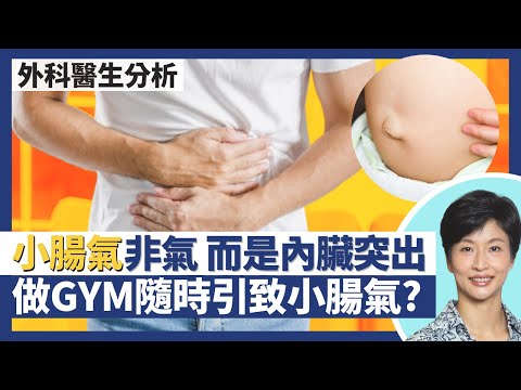 小腸氣/疝氣≠氣 腹腔壁破洞致內臟突出?健身做GYM不當/生育都可能引致小腸氣?10個小腸氣9個為男士全因一個先天因素|王建芳醫生 外科醫生何柏堅醫生|人類健康研究所