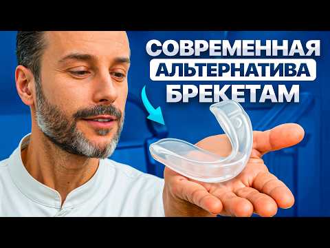 БРЕКЕТЫ или ЭЛАЙНЕРЫ? Все сложности и нюансы элайнеров — разбор на реальном примере