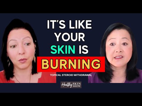 THIS Can Help You Heal Topical Steroid Withdrawal (TSW) | Olivia Hsu Friedman