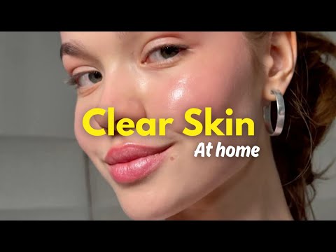 How To ACTUALLY Get Clear Skin FAST | Don't Skip This