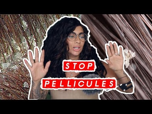 SOLUTIONS NATURELLES POUR LES PELLICULES GRASSES/SÈCHES