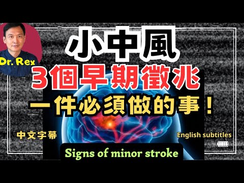 小中風後必定要做的一件事!what is minor stroke and what must be done after an attack?