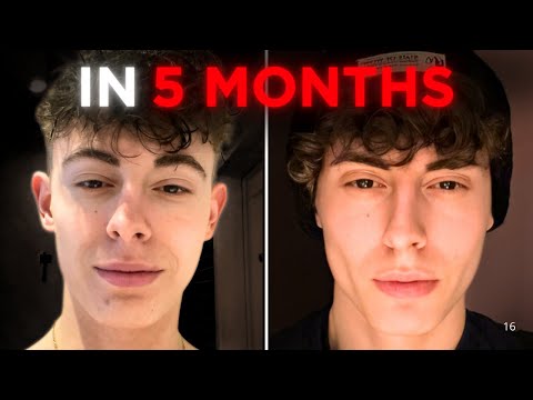 I Trained My Face Like a Muscle, The Results Shocked Me