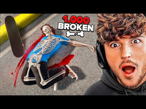 Breaking All 1000 BONES As a Professional Skateboarder!