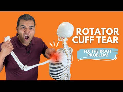 Rotator Cuff Tear Everything You Need To Know To Understand & Fix The Root Problem