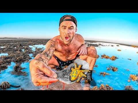 My Finger Got Bit OFF - World's Deadliest Octopus