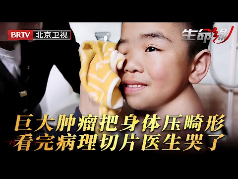 巨大肿瘤把身体压成畸形,9岁男童走路都打晃,肿瘤密密麻麻数不清,看完病理切片医生也哭了……【生命缘第14季】