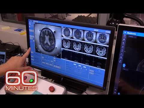 Medical breakthroughs and health stories | 60 Minutes Marathon
