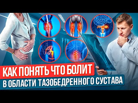 БОЛЬ В БЕДРЕ. Почему болит бедро и как лечить? Как понять что болит в области тазобедренного сустава