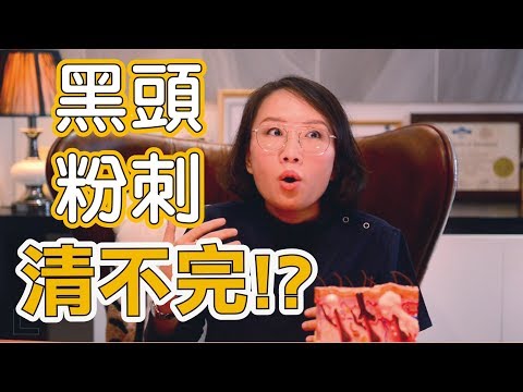黑頭粉刺清都清不完,我該如何有效清粉刺?粉刺我到底該不該清?