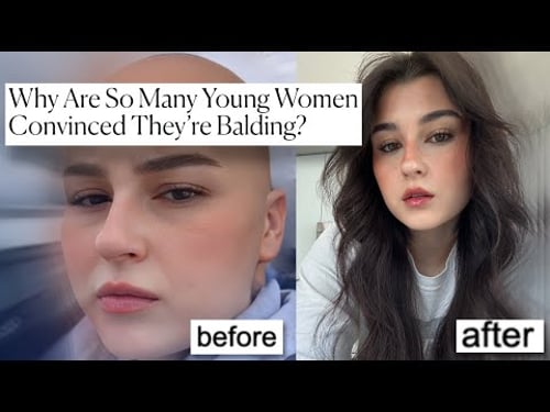 if you're worried you're going bald, this video is for you.