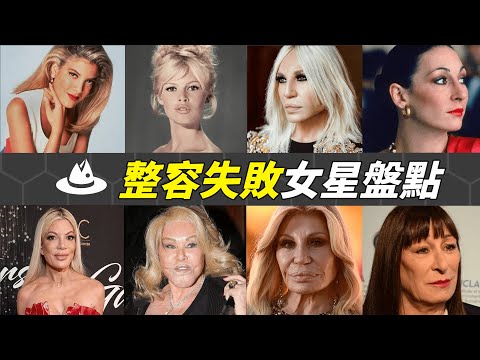 歐美女星整容失敗下場有多慘?不僅面目全非容貌盡毀,甚至因形象太醜遭業界封殺!|#魚樂說 #娛樂 #明星 #人物誌