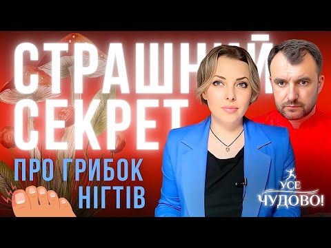 Найкращий засіб проти грибка. Грибок нігтів легко лікується! Лікар Василь Чайка
