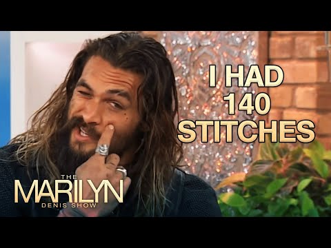 Jason Momoa Reveals How He Got That Iconic Scar | The Marilyn Denis Show