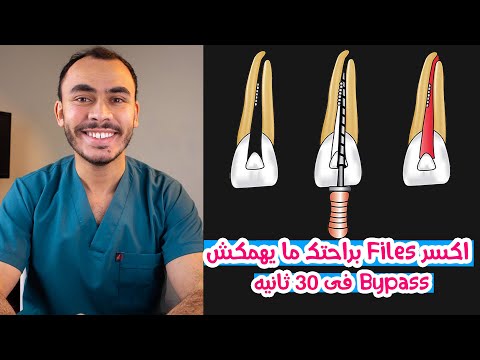 How to Bypass Broken File in 30 Sec