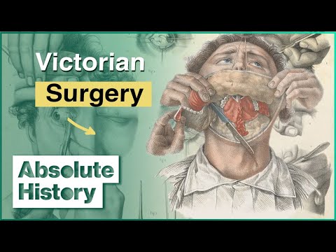 The Unbeleivable Impact Of Victorian Medicine | How The Victorians Built Britain