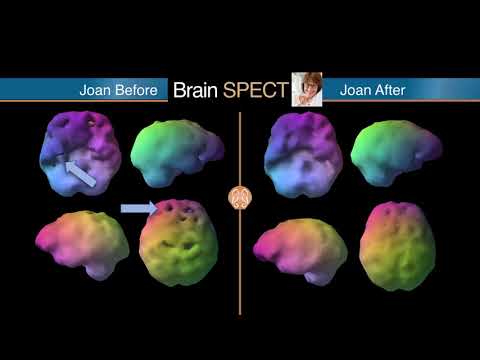 BRIGHT MINDS - M is for Mental Health