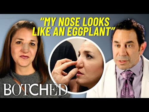 Margo’s Nose Won’t Stop Getting BIGGER After A Botched Nose Job At 15 | Botched | E!