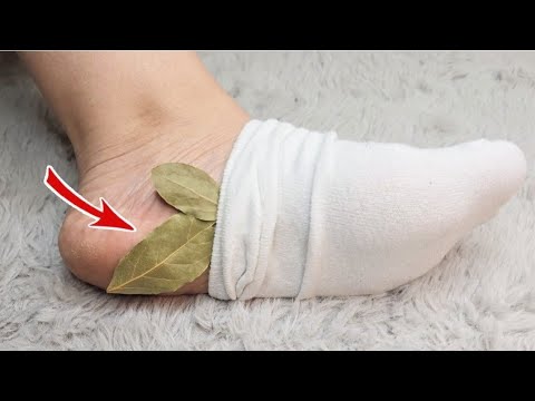 I would die and not know! Put a bay leaf on your feet and don't spend money at the market