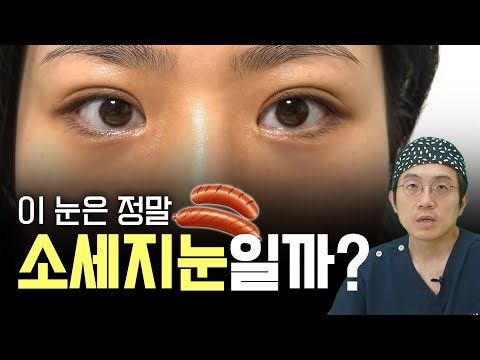 편집자 : "아..나는 소세지눈 되겠다..."(온라인성형상담)
