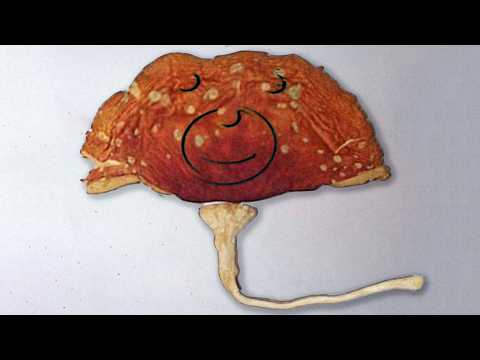 A Man Macrodosed Forest-Picked Mushrooms. This Is What Happened To His Organs.