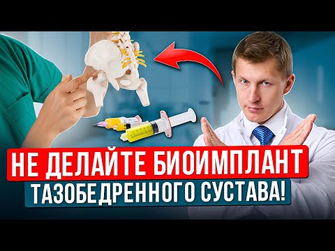 Все, что вы хотели знать о Биоимплантах тазобедренного сустава. Лечение сустава без операции.