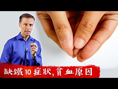 缺鐵10症狀,貧血原因,自然療法,柏格醫生 Dr Berg