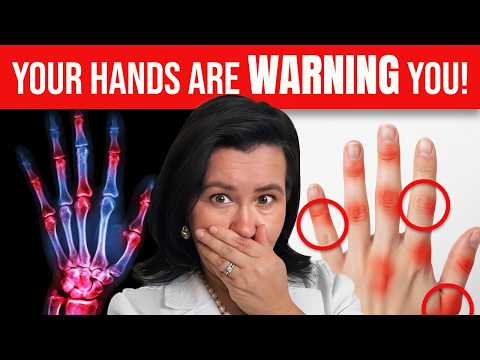 #1 SHOCKING Sign of Rheumatoid Arthritis