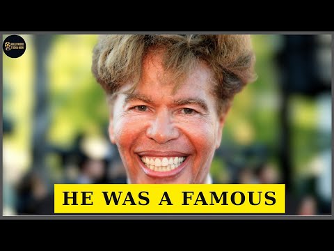 10 Male Celebrities Who Took Plastic Surgery TOO FAR – You Won't Believe | Then and Now 2026