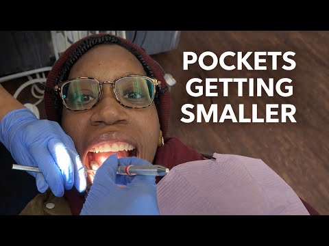 My Gum Pockets Keep Improving! 🤩Dental Update! #dentalhealth #healthygums #wellnessjourney