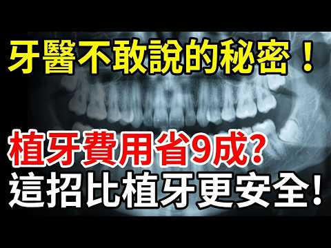 Why are dentists so eager to recommend dental implants? A senior dentist reveals: There's another...