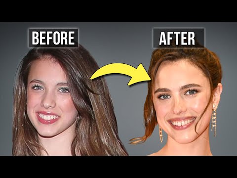 I Was Wrong About Margaret Qualley Being Natural; the Plastic Surgery I Missed...