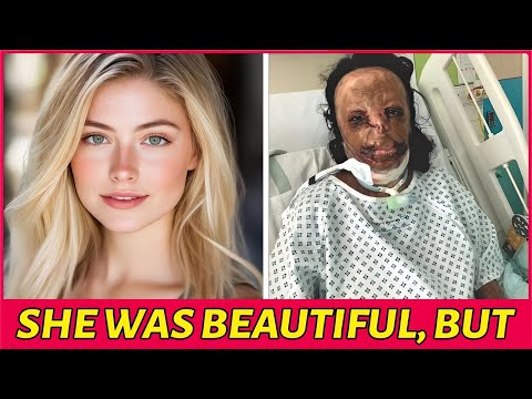 20 People Who Regretted Changing Their Race With Surgery | Then and Now 2025