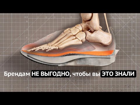 Carbon, pronation, supination — the BIG LIE of running marketing