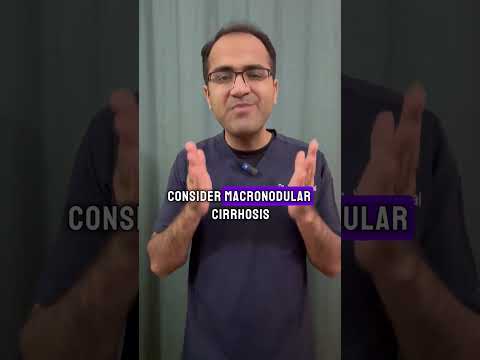 Pro Doc Tip 36 Hepatomegaly with irregular margins and Nontendor Differential Diagnosis Neetpg USMLE