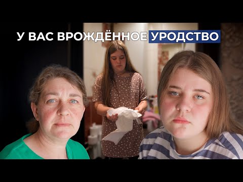 ЭКСТРОФИЯ МОЧЕВОГО ПУЗЫРЯ | История Наташи Вернер