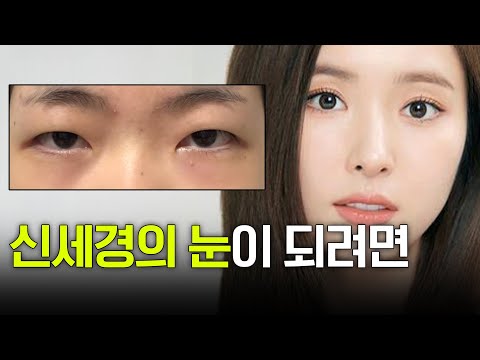 저보다 의사가 더 잘아니까, 의사가 하라는대로 수술 해야 되는 거 아닌가요?