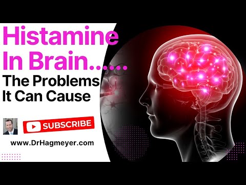 Is Excess Brain Histamine The Cause of Your Symptoms? Histamine causes brain fog