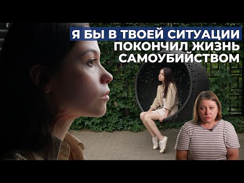 ПОСЛЕОЖОГОВЫЕ РУБЦЫ ТЕЛА | История Ренаты Степановой