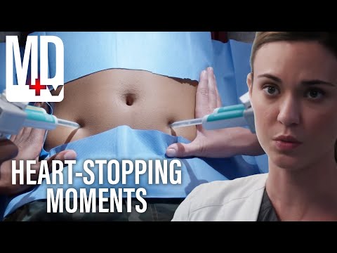 Most Shocking Moments | Pure Genius | MD TV