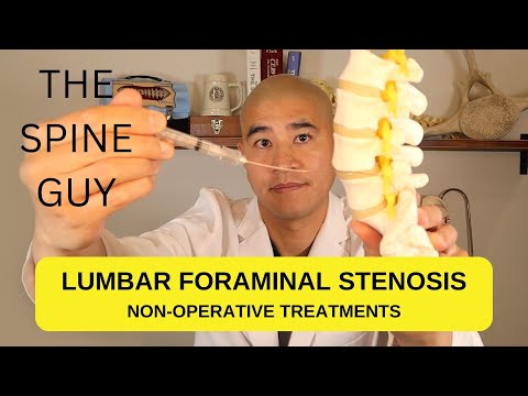 Lumbar Foraminal Stenosis - Non Operative Treatments
