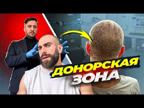ИДЕАЛЬНАЯ ДОНОРСКАЯ ЗОНА, КАКАЯ ОНА?